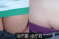 1-160G5142920K6.jpg