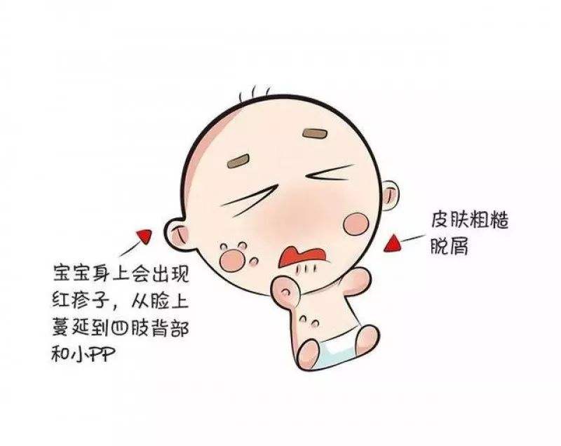 学生湿疹应该怎么治疗