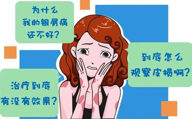 冬季牛皮癣发作怎么办